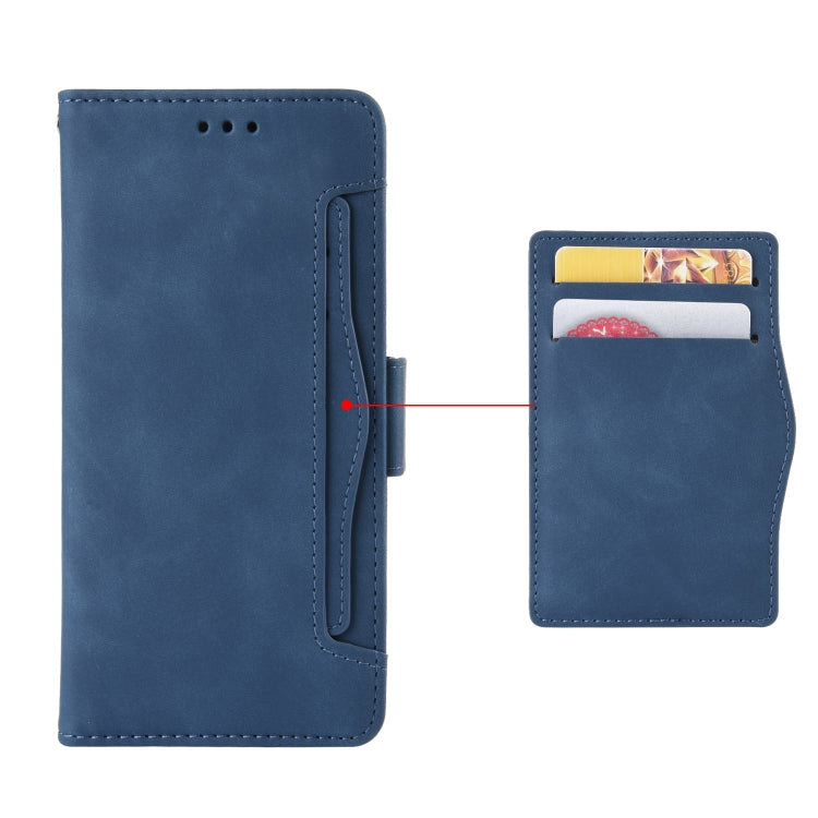 For Doogee X96 Pro Skin Feel Calf Pattern Horizontal Flip Leather Case with Holder & Card Slots & Photo Frame(Blue) - More Brand by PMC Jewellery | Online Shopping South Africa | PMC Jewellery | Buy Now Pay Later Mobicred