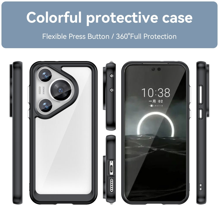 For Huawei Pura 70 Pro+ Colorful Series Acrylic + TPU Phone Case(Black) - Huawei Cases by PMC Jewellery | Online Shopping South Africa | PMC Jewellery | Buy Now Pay Later Mobicred