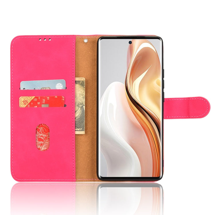 For Ulefone Note 17 Pro Skin Feel Magnetic Flip Leather Phone Case(Rose Red) - Ulefone Cases by PMC Jewellery | Online Shopping South Africa | PMC Jewellery | Buy Now Pay Later Mobicred