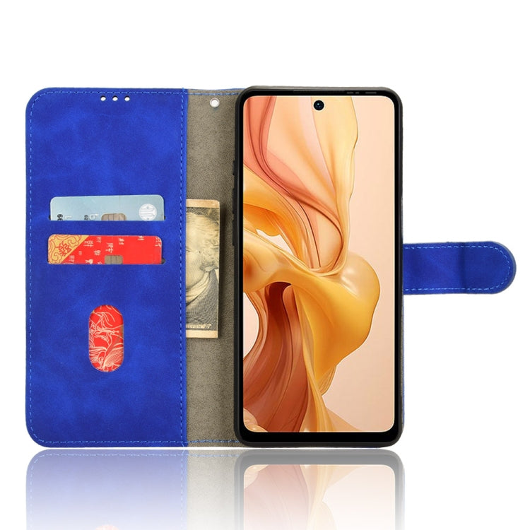 For Ulefone Note 18 Ultra Skin Feel Magnetic Flip Leather Phone Case(Blue) - free shipping - PMC Jewellery - Order now!