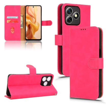 For Ulefone Note 18 Ultra Skin Feel Magnetic Flip Leather Phone Case(Rose Red) - Ulefone Cases by PMC Jewellery | Online Shopping South Africa | PMC Jewellery | Buy Now Pay Later Mobicred