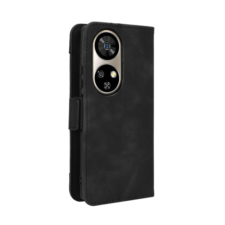 For Ulefone Note 17 Pro Skin Feel Calf Texture Card Slots Leather Phone Case(Black) - Ulefone Cases by PMC Jewellery | Online Shopping South Africa | PMC Jewellery | Buy Now Pay Later Mobicred